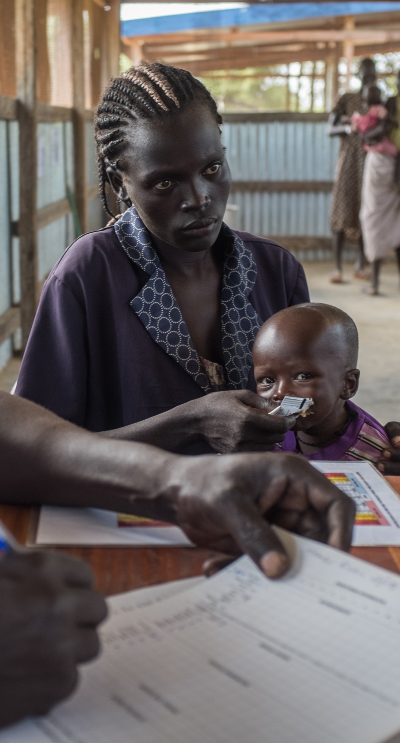 A malnourished child is treated in one of Action Against Hunger's health centers in South Sudan.