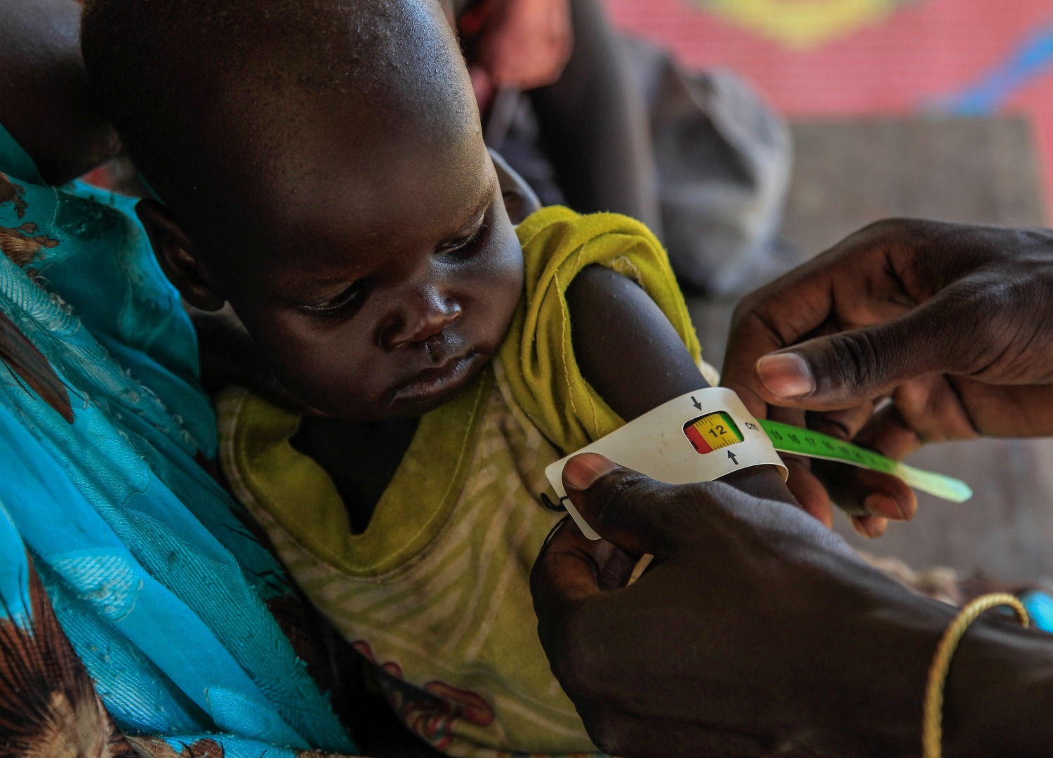 Atong's upper arm is measured, and she is diagnosed with severe acute malnutrition. Her case is a complicated one - she also has pneumonia.