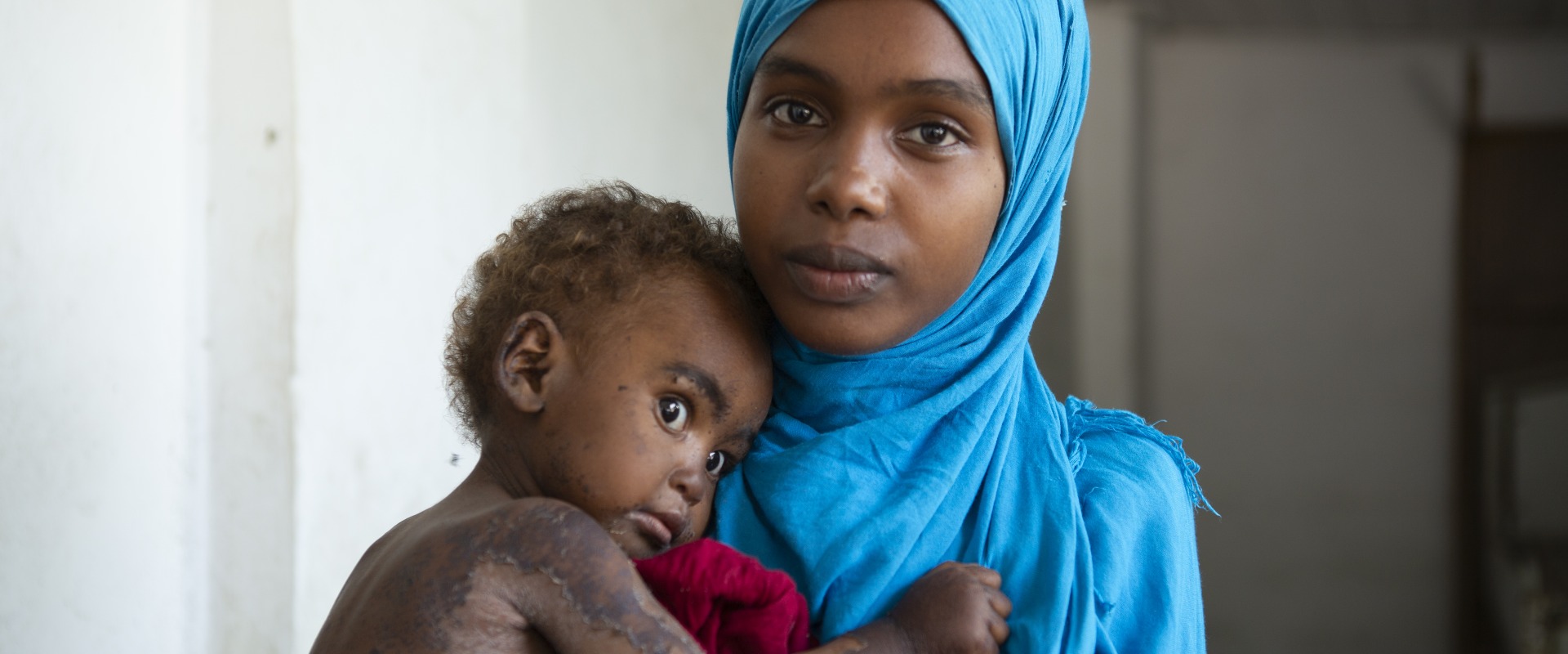 A woman holder her baby in Somalia