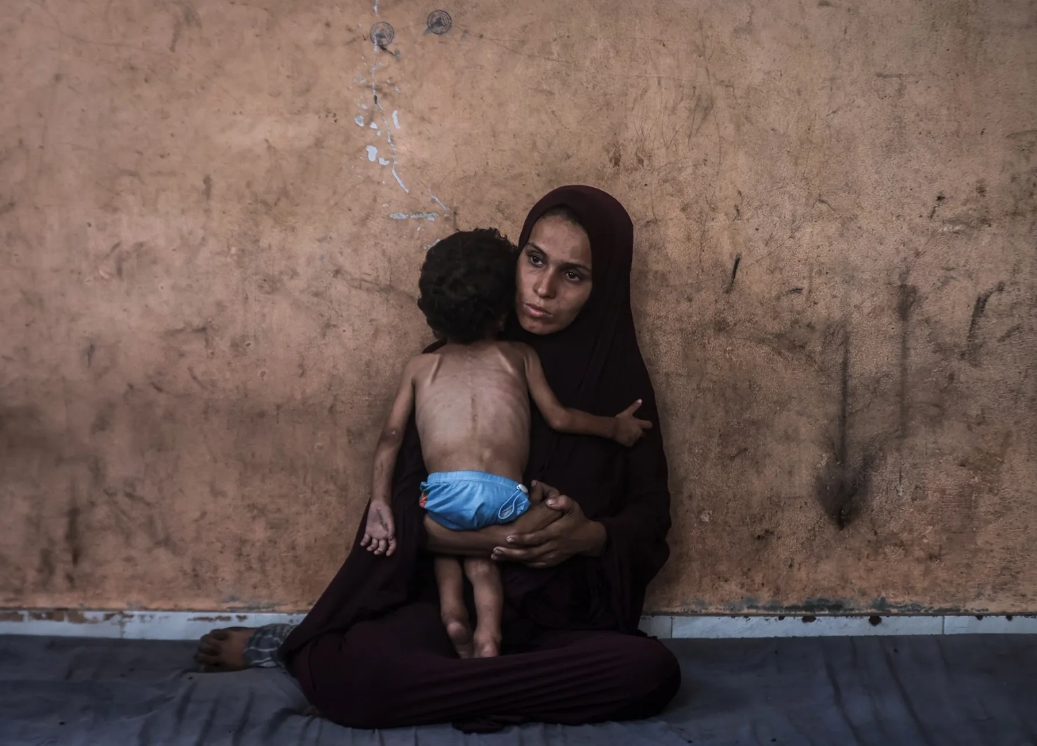 A woman holds a severely malnourished child in Gaza.