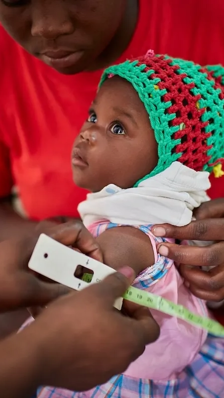 A child is screened for malnutrition in Haiti.